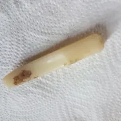ARM TIP