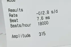30MM REF