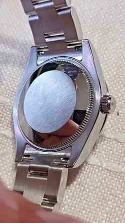 DIAL 31MM WATCH