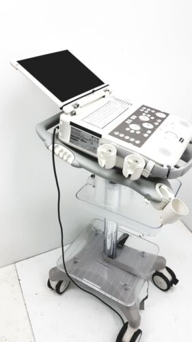 Siemens Acuson P300 Portable Ultrasound Machine